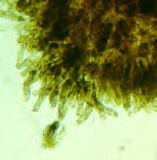 apiosoma